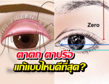 แก้ปัญหาตาตก ตาปรือ วิธีไหนดี ระหว่าง Subbrown Lift หรือ ทำตา2ชั้น