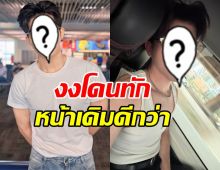นักร้องหนุ่มดัง งง! โดนทักน่าเสียดาย หน้าเดิมดีกว่า
